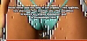 People With Double Sex Organs Porn 35